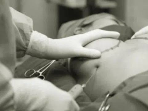 Thu gọn ngực ở spa cô gái 22 tuổi nhập viện khẩn cấp