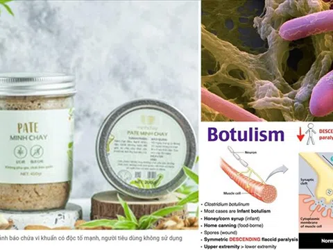 Vi khuẩn Clostridium botulinum được tìm thấy trong Pate Minh Chay chứa độc tố gây chết người