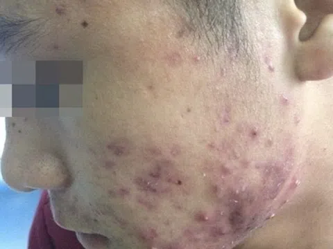 Vỡ mộng làm đẹp bằng mỹ phẩm “hàng hiệu” giá bèo