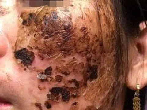 Khách hàng bị “nát mặt” vì… dự hội thảo làm đẹp!