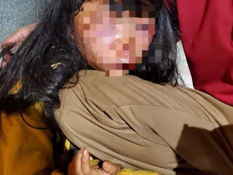 Bà Rịa–Vũng Tàu: Nữ sinh lớp 6 bị đối tượng lạ mặt đánh dã man