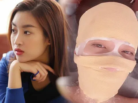 Hoa hậu Đỗ Mỹ Linh đăng story băng bó cả mặt, dân tình hỏi thăm mới tá hỏa và sự thật
