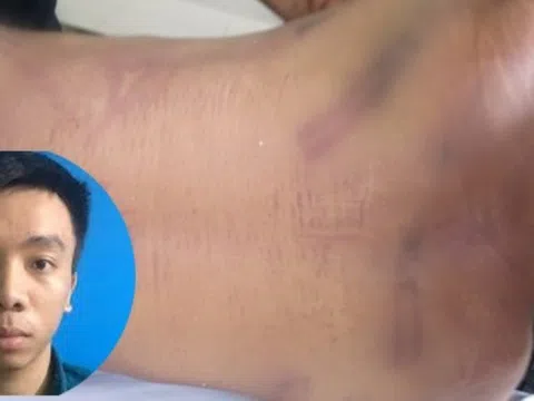 Ngày mai, xét xử vụ phạm nhân bị đánh chết tại nhà tạm giữ