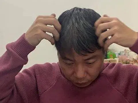 Nghệ sĩ Chí Trung tiết lộ lý do Công Lý bị tẩu hỏa